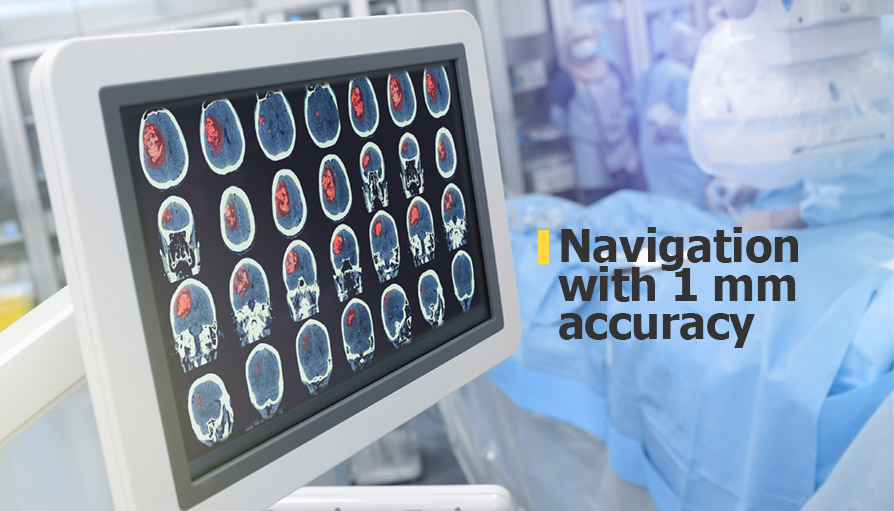 Neuronavigator: optical navigation system for neurosurgeons